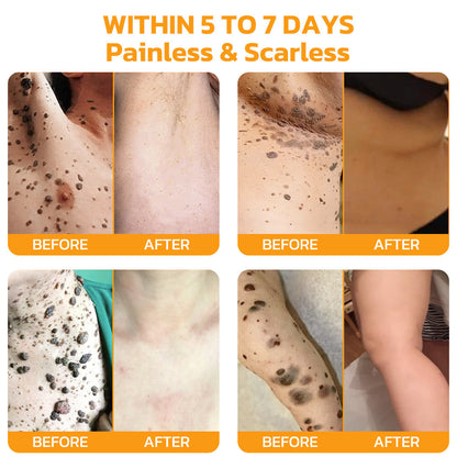 Furzero™ Bee Venom Skincare Treatment Pads (👩🏼⚕️ASCD Recommended)