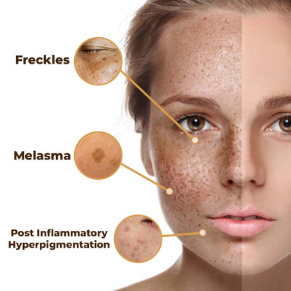 flysmus™ PeptideLuxe Melanin Vanish Serum 🌿 Natural Ingredients 🇦🇺 ASCD Approved